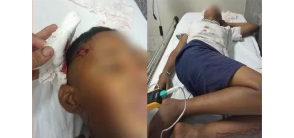 Menino de 11 anos tem crânio rachado após ser agredido com paulada em escola